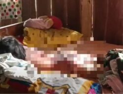 Bocah Perempuan Dibakar Temannya di Semarang, Kini Alami Trauma