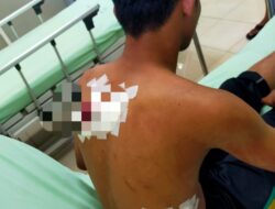 Remaja di Sragen Lolos Dari Maut Setelah Alami Luka Tusuk, Polisi Kerahkan Tim Penyelidik Kejar Pelaku