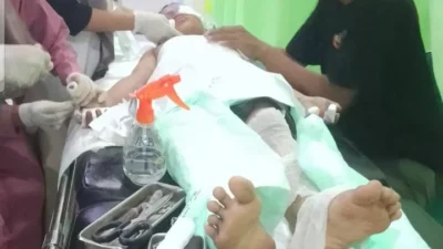 Sejumlah Anak di Slogohimo Wonogiri Mengalami Luka Bakar Terkena Ledakan Petasan